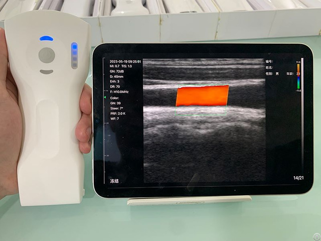 8cpl 3in1 Palm Doppler Ultrasound