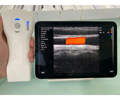 8cpl 3in1 Palm Doppler Ultrasound
