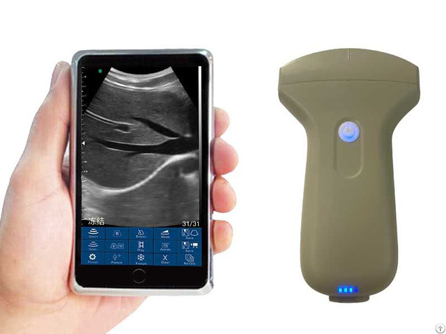Convex Palm Doppler Ultrasound