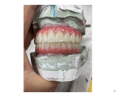 China Dental Lab Implant Crowns