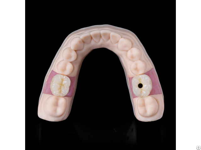 Implant Dental Laboratory