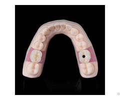 Implant Dental Laboratory