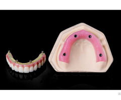 Cement Retained Implant