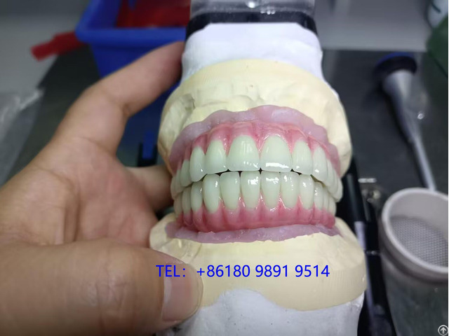 Cementable Custom Titanium Abutments