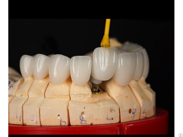 Quality Implant Bar And Flexible Partial Factory From China