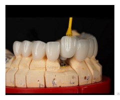 Quality Implant Bar And Flexible Partial Factory From China