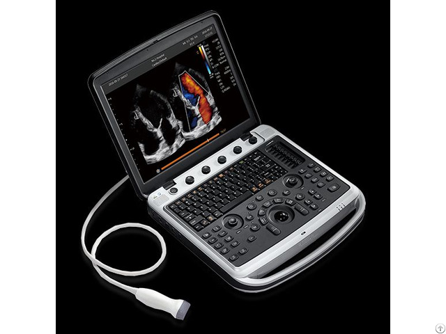 Portable Vascular Ultrasounds