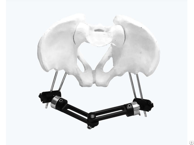 Pelvic External Fixator Double Strand