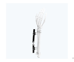 Wrist External Fixator