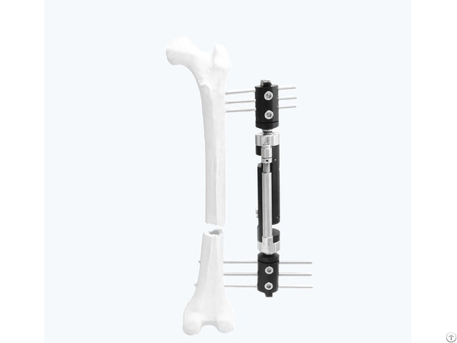 Lower Limb Micromotion External Fixator Straight Type
