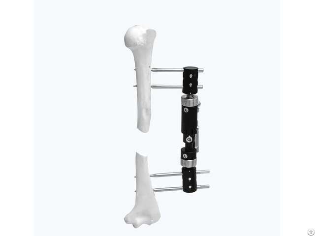 Paediatric Micromotion External Fixator Straight Type