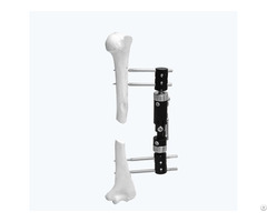 Paediatric Micromotion External Fixator Straight Type