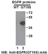 Anti Egfr G719s Mouse Monoclonal Antibody