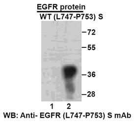 Anti Egfr L747 P753 S Mouse Monoclonal Antibody