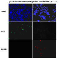 Anti Erbb2 V777a Mouse Monoclonal Antibody