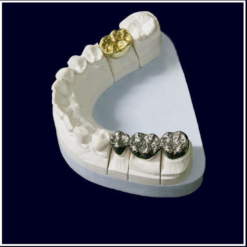 Dental Full Cast Np Gold Crown And Bridge Fcc Denture Restoration