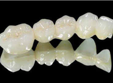 Dental Ips E Max All Ceramic Crown Empress Casting Porcelain Bridge