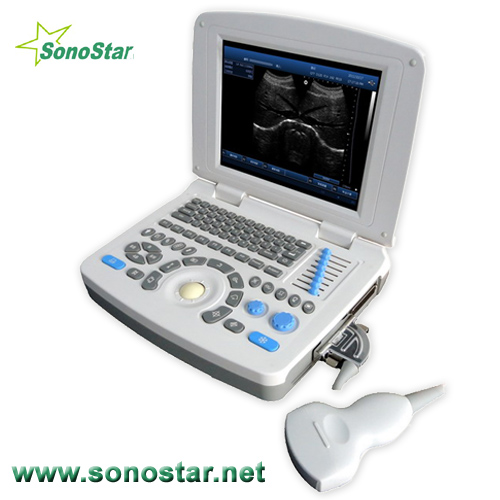 Ss 10 Laptop Pc Based Ultrasound B Scanner 3d Image Optional