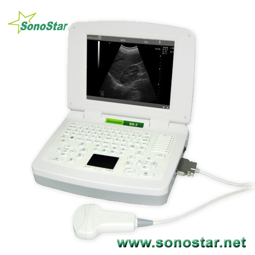 Ss 3 Laptop Ultrasound B Scanner Ultrasoni Black White