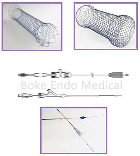 Colon Stent Otw Tts Self Expandable Stents