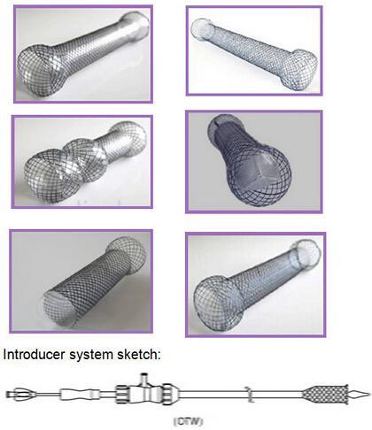 Covered Esophageal Stent