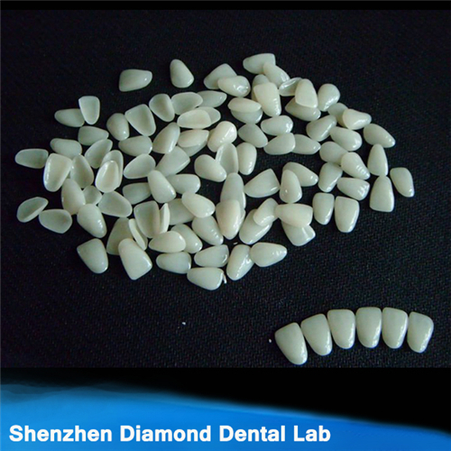 Dental All Ceramic Veneers