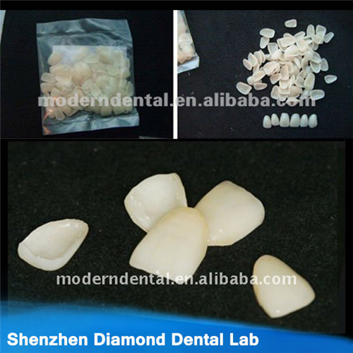 Dental Empress Ceramic Veneers Or Lumineers