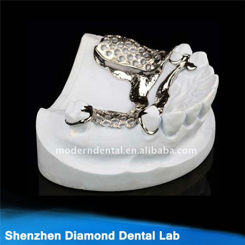 Dental Metal Partial Framework