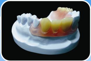 Flexible Denture Valplast Endura Resin Teeth Base Plate