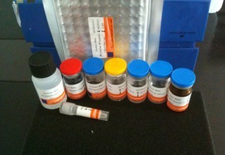 Human Amylin Elisa Kit