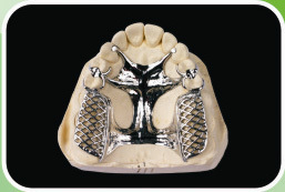 Metal Framework Co Cr Pure Titanium With Clasp Denture