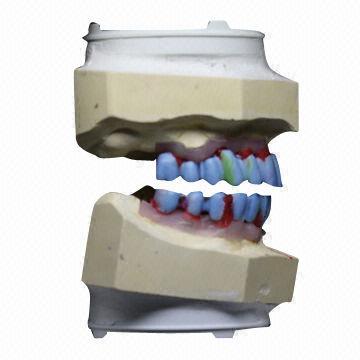 U L Implant Bridge Zirconium Alumina Valplast