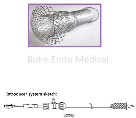 Umbrella Gastric Fistula Stent